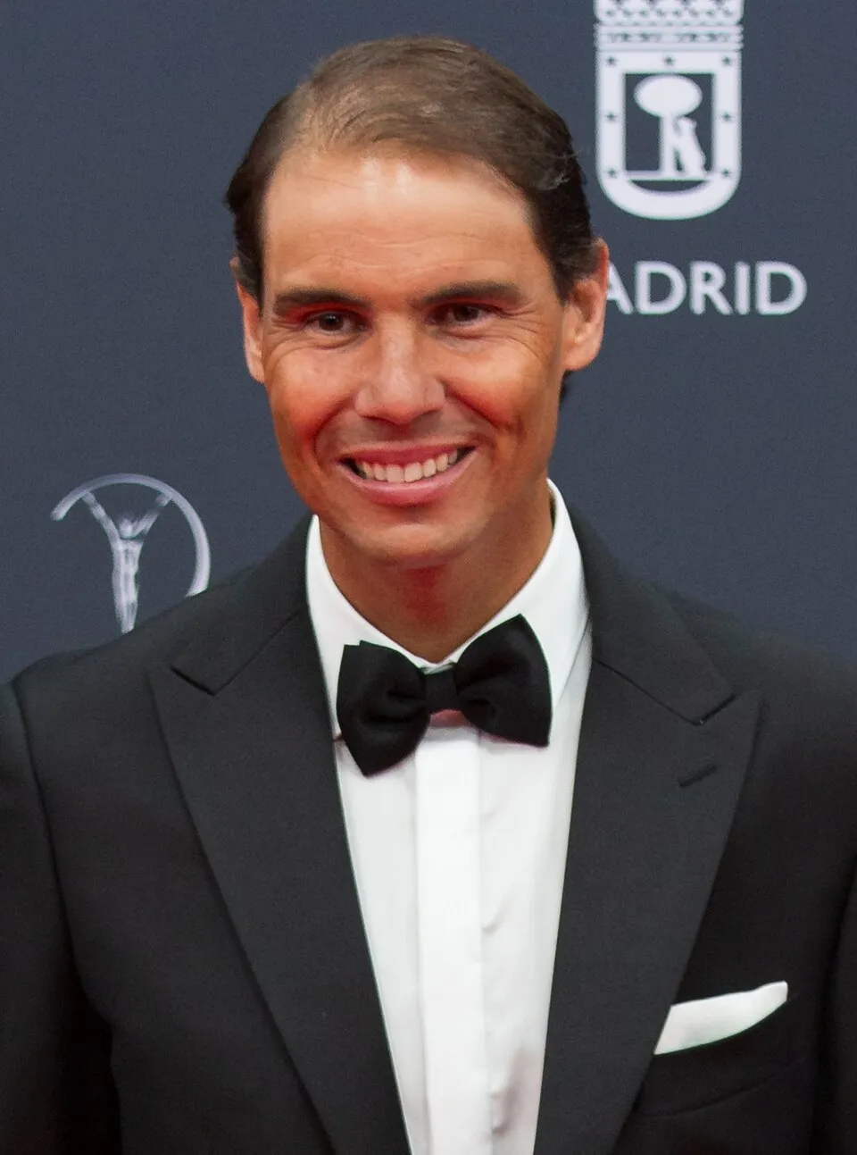 Petenis asal Spanyol Rafael Nadal saat bertanding di lapangan tenis